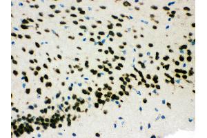 Anti- SMN1/2 Picoband antibody,IHC(P) IHC(P): Mouse Brain Tissue (SMN1 / SMN2 (AA 22-52), (N-Term) antibody)