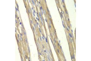 Immunohistochemistry of paraffin-embedded rat heart using CASP7 antibody (ABIN5970716) at dilution of 1/100 (40x lens).