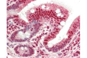 Human Small Intestine: Formalin-Fixed, Paraffin-Embedded (FFPE) (NMNAT1 antibody  (AA 229-279))