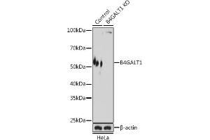 Western blot analysis of extracts from normal (control) and B4G knockout (KO) HeLa cells, using B4G antibody (ABIN6133203, ABIN6137403, ABIN6137404 and ABIN6224642) at 1:3000 dilution. (B4GALT1 antibody  (AA 50-215))