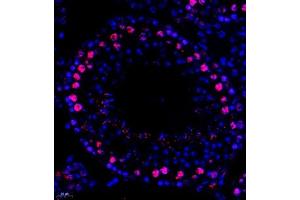 Immunofluorescent analysis of paraffin embedded mouse testis using MED8 (ABIN7074582) at dilution of 1: 600 (MED8 antibody)