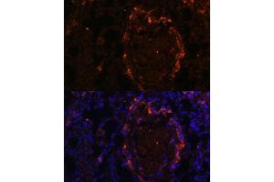 Immunofluorescence analysis of rat lung using BTN3 Polyclonal Antibody (0288) at dilution of 1:100 (40x lens).