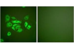 Immunofluorescence analysis of A549 cells, using Keratin 10 Antibody. (Keratin 10 antibody  (AA 136-185))
