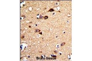 Formalin-fixed and paraffin-embedded human brain tissue with UNC5C Antibody (Center), which was peroxidase-conjugated to the secondary antibody, followed by DAB staining. (Unc5c antibody  (AA 188-217))