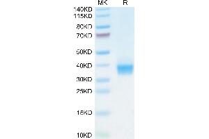 Biotinylated Cynomolgus PD-L1 on Tris-Bis PAGE under reduced conditions. (PD-L1 Protein (AA 19-238) (His tag,Biotin))