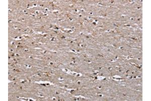 The image on the left is immunohistochemistry of paraffin-embedded Human brain tissue using ABIN7191114(IQCJ Antibody) at dilution 1/30, on the right is treated with synthetic peptide. (IQCJ antibody)