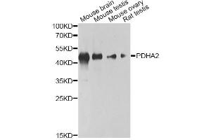 Western blot analysis of extracts of various cell lines, using PDHA2 antibody (ABIN6293728) at 1:1000 dilution.