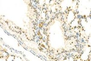Immunohistochemistry analysis of paraffin-embedded mouse lung using,IOP2 (ABIN7074883) at dilution of 1: 2000 (NARF antibody)