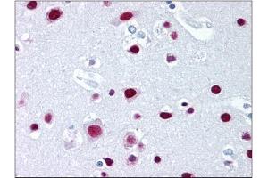 Immunohistochemistry (IHC) image for anti-Scaffold Attachment Factor B2 (SAFB2) (AA 345-357) antibody (ABIN302304)