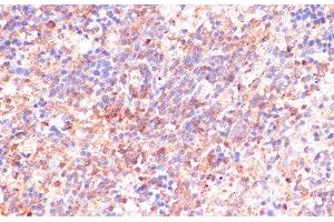 Immunohistochemistry of paraffin-embedded Rat spleen using CDC20 Polyclonal Antibody at dilution of 1:100 (40x lens). (CDC20 antibody)