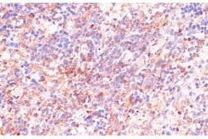 Immunohistochemistry of paraffin-embedded Rat spleen using CDC20 Polyclonal Antibody at dilution of 1:100 (40x lens).