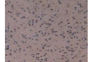 IHC-P analysis of Mouse Brain Tissue, with DAB staining. (NPPC antibody  (AA 30-126))