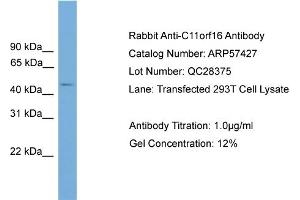 WB Suggested Anti-C11orf16  Antibody Titration: 0. (C11ORF16 antibody  (Middle Region))