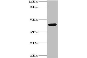 Western blot All lanes: Interleukin-1 receptor type 2 antibody at 3 μg/mL + Mouse kidney tissue Secondary Goat polyclonal to rabbit IgG at 1/10000 dilution Predicted band size: 46, 34 kDa Observed band size: 46 kDa (IL1R2 antibody  (AA 20-320))