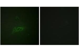 Immunofluorescence analysis of HeLa cells, using CD45 (Phospho-Ser1007) Antibody. (CD45 antibody  (pSer1007))