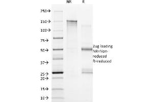 SDS-PAGE (SDS) image for anti-Membrane-Spanning 4-Domains, Subfamily A, Member 1 (MS4A1) antibody (ABIN6941106)