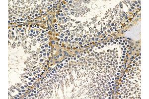 ABIN7097176 and ABIN7101244 at 1/100 staining rat testis tissue by IHC-P. (AP1S2 antibody)