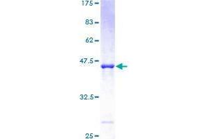 ARL5A Protein (AA 1-179) (GST tag)