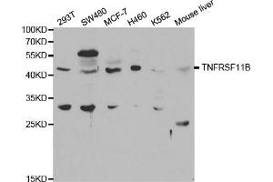 Western blot analysis of extracts of various cell lines, using TNFRSF11B antibody (ABIN5971126) at 1/1000 dilution. (Osteoprotegerin antibody)