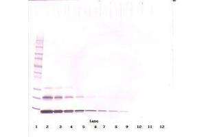 Image no. 1 for anti-Chemokine (C-C Motif) Ligand 16 (CCL16) antibody (ABIN465913)
