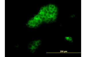 Immunofluorescence of monoclonal antibody to RHOA on A-431 cell.