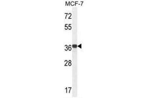 GPD1L Antibody (N-term) western blot analysis in MCF-7 cell line lysates (35µg/lane). (GPD1L antibody  (N-Term))