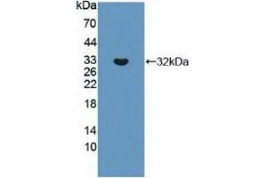 Western blot analysis of recombinant Human ABCC8. (ABCC8 antibody  (AA 679-929))