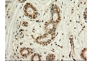 Image no. 2 for anti-Myc Proto-Oncogene protein (MYC) antibody (ABIN1497011) (c-MYC antibody)