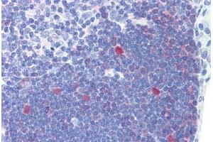 Human Thymus (formalin-fixed, paraffin-embedded) stained with CDC2 antibody ABIN462355 followed by biotinylated anti-mouse IgG secondary antibody ABIN481714, alkaline phosphatase-streptavidin and chromogen. (CDK1 antibody)