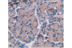 Immunohistochemistry (Paraffin-embedded Sections) (IHC (p)) image for anti-Interleukin 6 (IL6) (AA 21-211) antibody (ABIN6002527)