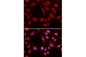 Immunofluorescence (IF) image for anti-Proteasome (Prosome, Macropain) 26S Subunit, Non-ATPase, 7 (PSMD7) antibody (ABIN1876544) (PSMD7 antibody)