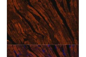 Immunofluorescence analysis of Mouse heart using MYH6 Polyclonal Antibody at dilution of 1:100. (MYH6 antibody)
