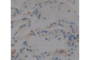 IHC-P analysis of Human Tissue, with DAB staining. (IL1F9 antibody  (AA 1-162))