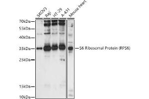 Western blot analysis of extracts of various cell lines, using S6 Ribosomal Protein (RPS6) antibody (ABIN6133901, ABIN6147227, ABIN6147228 and ABIN6221687) at 1:1000 dilution. (RPS6 antibody  (AA 1-100))
