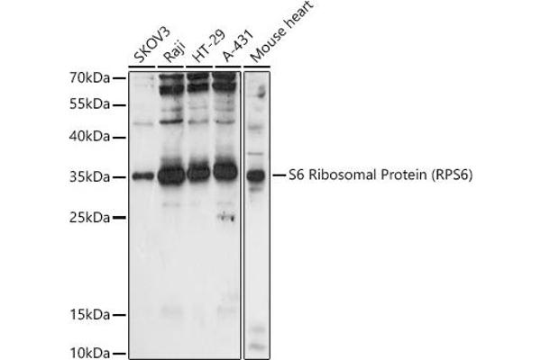 RPS6 抗体  (AA 1-100)