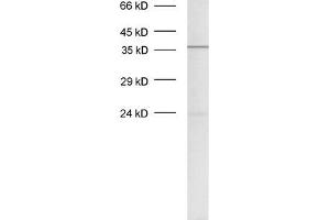dilution: 1 : 500, sample: crude synaptosomal fraction of rat brain (P2) (Syntaxin 12/13 (AA 1-250), (Cytoplasmic Domain) antibody)