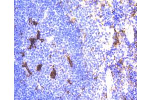 Immunohistochemistry of paraffin-embedded mouse spleen using LYZ antibody. (LYZ antibody)