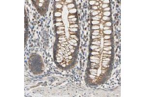 Immunohistochemical staining (Formalin-fixed paraffin-embedded sections) of human rectum with MBTPS2 polyclonal antibody  shows moderate cytoplasmic positivity in glandular cells at 1:20-1:50 dilution. (MBTPS2 antibody)
