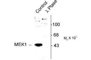 Image no. 2 for anti-Mitogen-Activated Protein Kinase Kinase 1 (MAP2K1) (pThr386) antibody (ABIN221148)