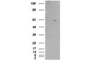 Image no. 1 for anti-Retinoid X Receptor, beta (RXRB) (Internal Region) antibody (ABIN374478) (Retinoid X Receptor beta antibody  (Internal Region))
