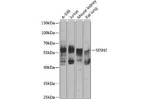 Western blot analysis of extracts of various cell lines, using SESN2 antibody (ABIN6128761, ABIN6147624, ABIN6147626 and ABIN6223421) at 1:1000 dilution. (Sestrin 2 antibody  (AA 211-480))
