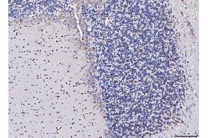 IHC analysis of FGF2 using anti-FGF2 antibody (ABIN7603215). (FGF2 antibody  (N-Term))