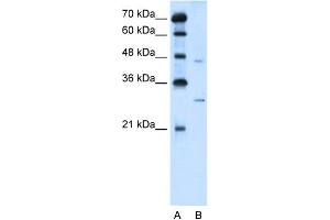 WB Suggested Anti-SLC36A3 Antibody Titration:  5. (SLC36A3 antibody  (N-Term))