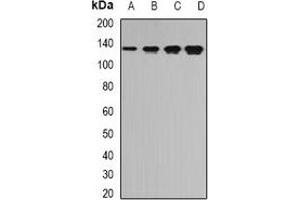 Western blot analysis of TPP2 expression in Jurkat (A), SW620 (B), mouse brain (C), mouse spleen (D) whole cell lysates. (Tpp2 antibody)