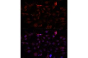Immunofluorescence analysis of HUVEC cells using CD34 antibody. (CD34 antibody)