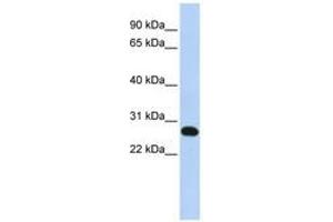 Image no. 1 for anti-Family With Sequence Similarity 119A (FAM119A) (N-Term) antibody (ABIN6741187) (FAM119A antibody  (N-Term))
