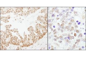anti-Cleavage Stimulation Factor, 3' Pre-RNA, Subunit 2, 64kDa (CSTF2) (AA 527-577) antibody