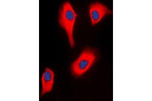 Immunofluorescent analysis of Glycerol Kinase 2 staining in HeLa cells.