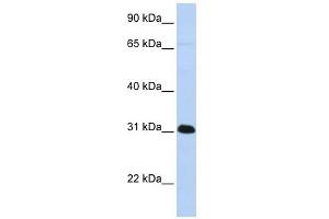 PADI4 antibody used at 1 ug/ml to detect target protein. (PAD4 antibody  (Middle Region))