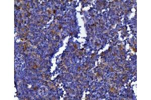IHC analysis of MSF/SEPTIN9 using anti-MSF/SEPTIN9 antibody (ABIN7600104). (Septin 9 antibody  (AA 15-282))